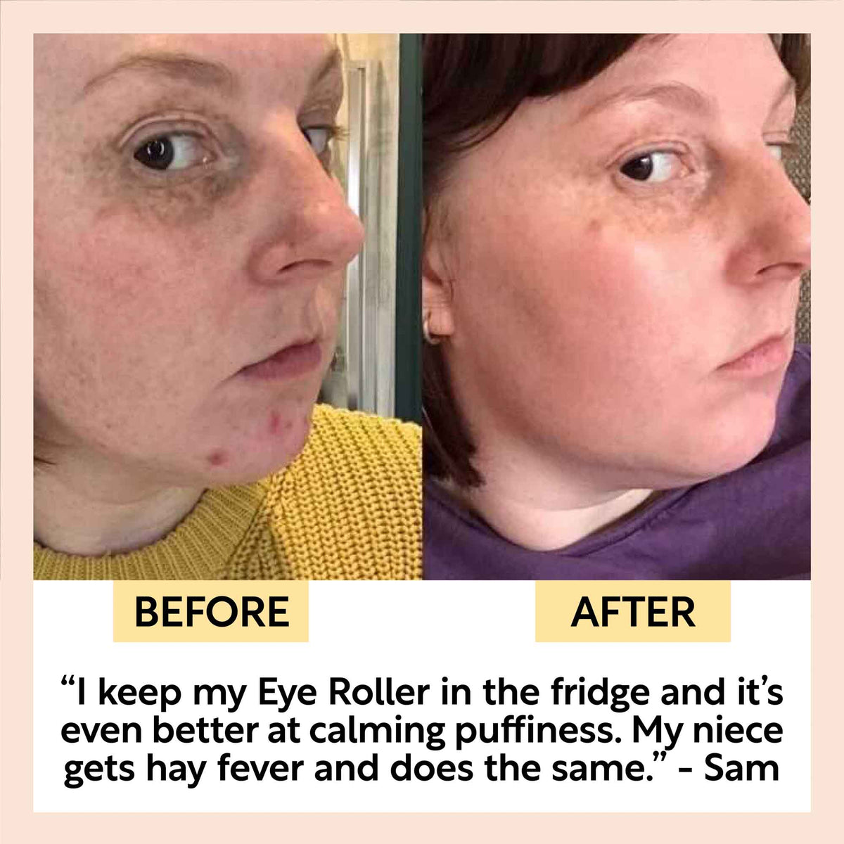 Day + Night Eye Care Bundle
